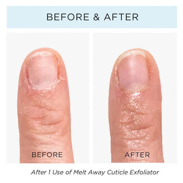 Melt Away Cuticle Exfoliator - Image 2